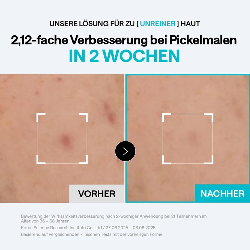 Mediheal Madecassoside Blemish Pad Quadratische Wattepads Mit Centella Asiatica Und Madecassoside, 1